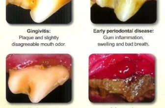 52 dental dog foods